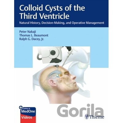 Colloid Cysts of the Third Ventricle - Peter Nakaji, Ralph Dacey, Thomas Beaumont