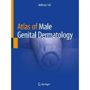 Atlas of Male Genital Dermatology | Anthony Hall (ISBN: 9783319997490)