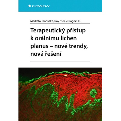 Terapeutický přístup k orálnímu lichen planus - nové trendy, nová řešení