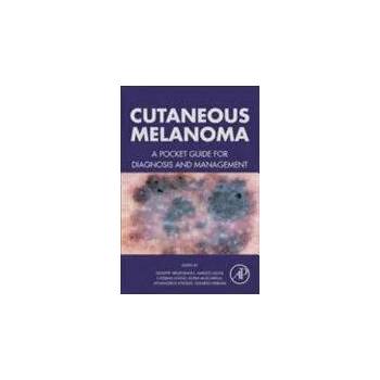 Image 1 of Cutaneous Melanoma | Giuseppe Argenziano
