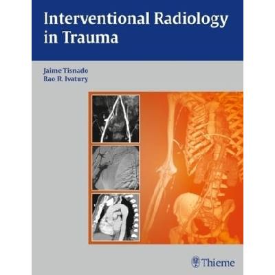 Interventional Radiology in Trauma