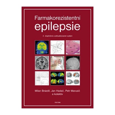 Farmakorezistentní epilepsie - Milan Brázdil, Jan Hadač, Petr Marusič