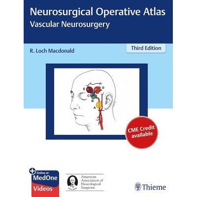 Neurosurgical Operative Atlas: Vascular Neurosurgery MacDonald R. LochPevná vazba