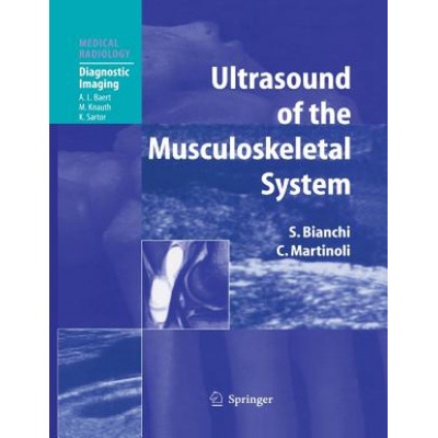 Ultrasound of the Musculoskeletal System Bianchi StefanoPaperback