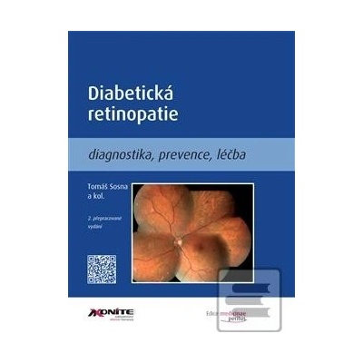 Diabetická retinopatie