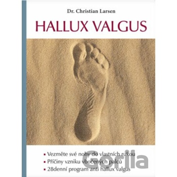 Hallux valgus