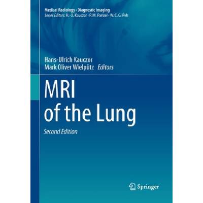 MRI of the Lung | Hans-Ulrich Kauczor, Mark Oliver Wielpütz