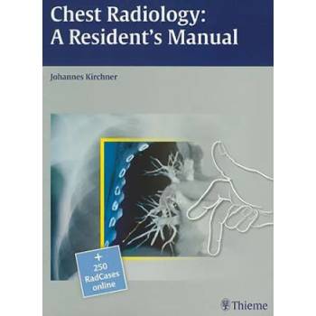 Image 1 of Chest Radiology: A Resident's Manual