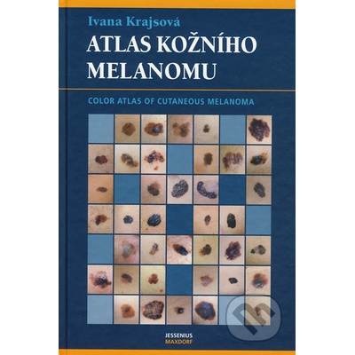 Atlas kožního melanomu - Ivana Krajsová