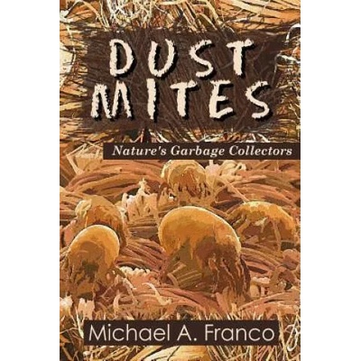 DUST MITES ? Nature's Garbage Collectors | MR Michael a Franco
