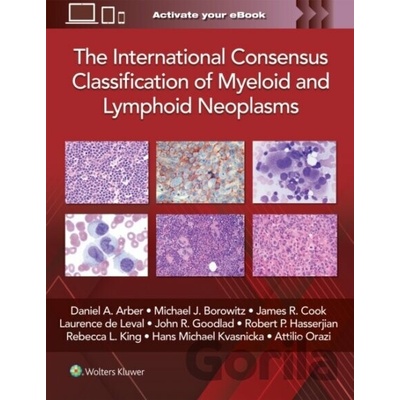 The International Consensus Classification of Myeloid and Lymphoid Neoplasms - Daniel A. Arber