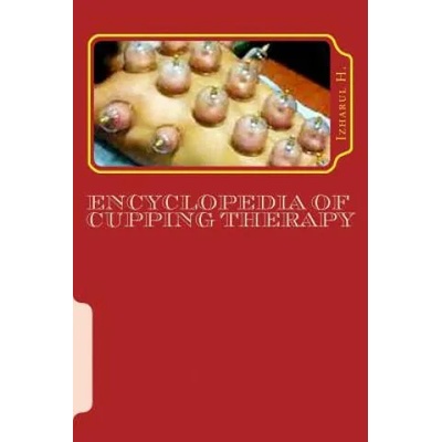 Encyclopedia of Cupping Therapy: Al-Hijama | Izharul H