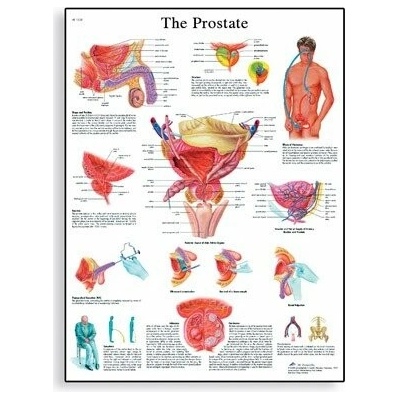 Schéma - ľudská prostata - AJ - 50x67 cm Papier bez lišty