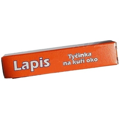 Ako sa správne starať o svoje nohy?
