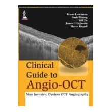 Clinical Guide to Angio-OCT: Non Invasive, Dyeless OCT Angiography - Lumbroso Bruno