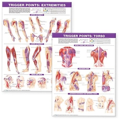 Trigger Point Chart Set: Torso & Extremities Lam" - "" ("")(Wallchart) (9780781773072)