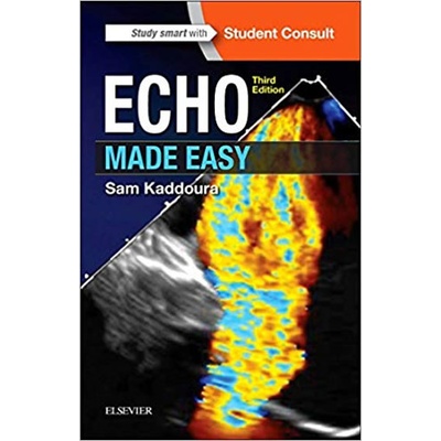 Echo Made Easy, 3rd Edition