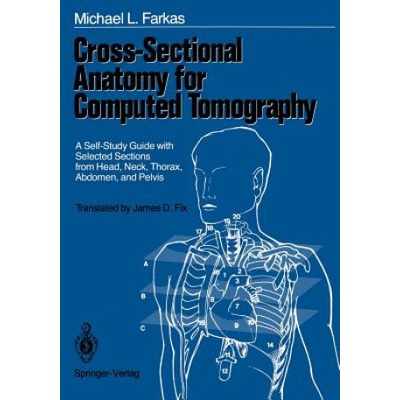 Cross-sectional Anatomy for Computed Tomography | M. Farkas