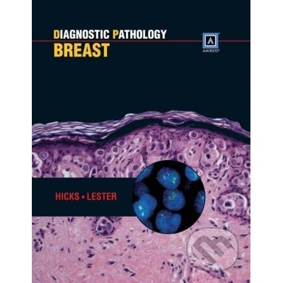 Diagnostic Pathology: Breast - David G. Hicks Susan C. Lester