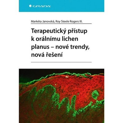 Terapeutický přístup k orálnímu lichen planus - nové trendy, nová řešení