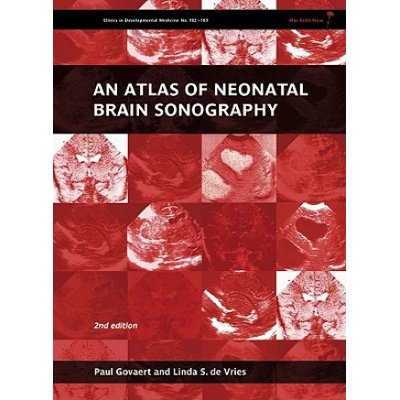 Atlas of Neonatal Brain Sonography Govaert Paul