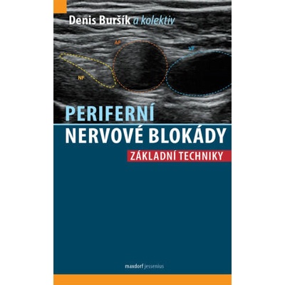 Periferní nervové blokády - Základní techniky | Denis Buršík