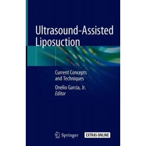 Ultrasound-Assisted Liposuction | Onelio Garcia (2019)