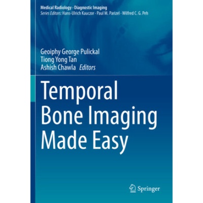 Temporal Bone Imaging Made Easy