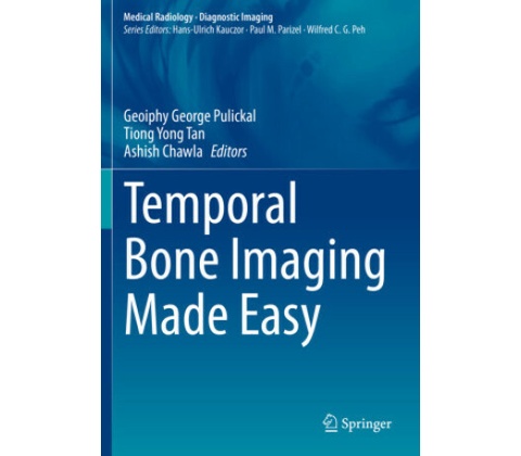 Temporal Bone Imaging Made Easy