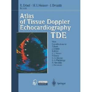 Atlas of Tissue Doppler Echocardiography - TDE | Raimund Erbel, H. J. Nesser, J. Drozdz (ISBN: 9783642470691)