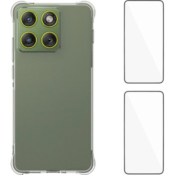 Motorola WANLONFENG Удароустойчив TPU Калъф за Motorola Edge 70 5G- Airbag технология, вкл. 2 бр Стъкло за Екран, Прозрачен