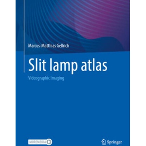 Slit lamp atlas | Marcus-Matthias Gellrich (2025)