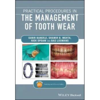 Image 1 of Practical Procedures in the Management of Tooth Wear | Subir Banerji