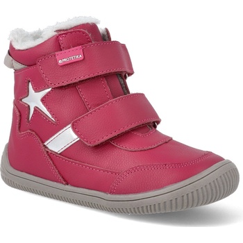 Protetika Tempra červená