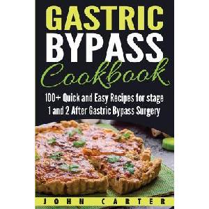Gastric Bypass Cookbook | John Carter (ISBN: 9781951103651)