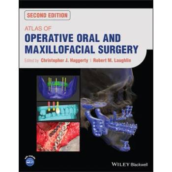 Image 1 of Atlas of Operative Oral and Maxillofacial Surgery
