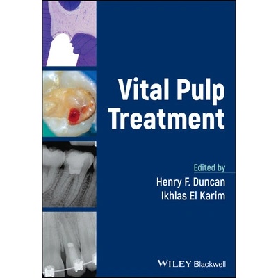 Vital Pulp Treatment - Duncan Henry F.