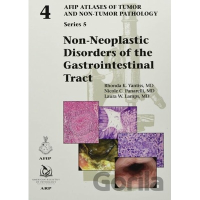 Non-Neoplastic Disorders of the Gastrointestinal Tract - Rhonda K. Yantiss, Nicole C. Panarelli, Laura W. Lamps