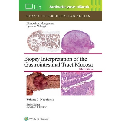 Biopsy Interpretation of the Gastrointestinal Tract Mucosa Volume 2 : Neoplastic - ELIZABETH ANNE MONTGOMERY, Lysandra Voltaggio