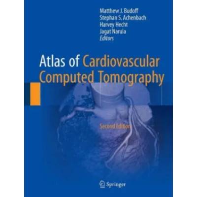 Atlas of Cardiovascular Computed Tomography | Matthew J. Budoff, Stephan S. Achenbach, Harvey S. Hecht, Jagat Narula