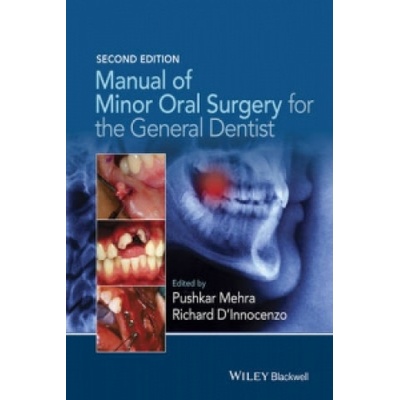 Manual of Minor Oral Surgery for the General Dentist Mehra Pushkar Boston University Henry M. Goldman School of Dental Medicine