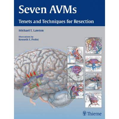 Seven AVMs | Michael T. Lawton