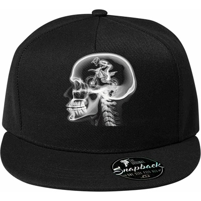 ENDURO v hlavě rentgen kedlubny 5P RAP