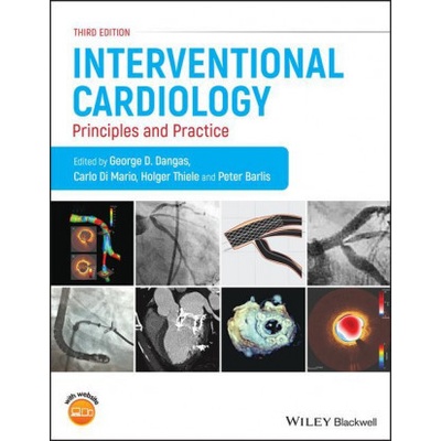 Interventional Cardiology