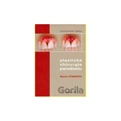 Plastická chirurgie parodontu