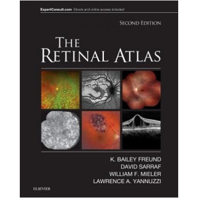 Retinal Atlas Freund K. Bailey