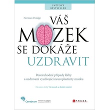 Váš mozek se dokáže uzdravit