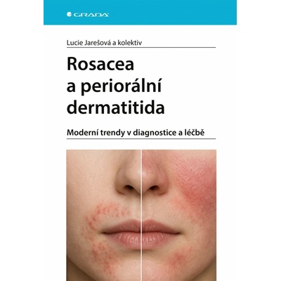 Rosacea a periorální dermatitida
