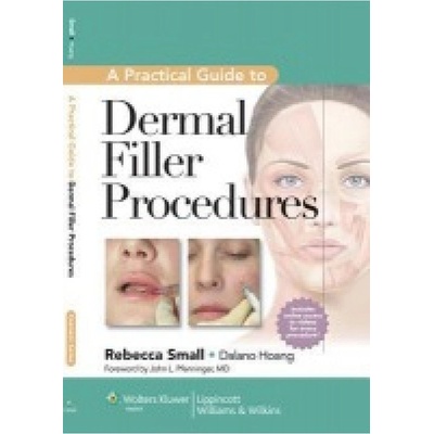 Practical Guide to Dermal Filler Procedures Lippincott Williams and Wilkins