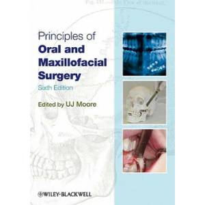 Principles of Oral and Maxillofacial Surgery 6e | U. J. Moore (2011)